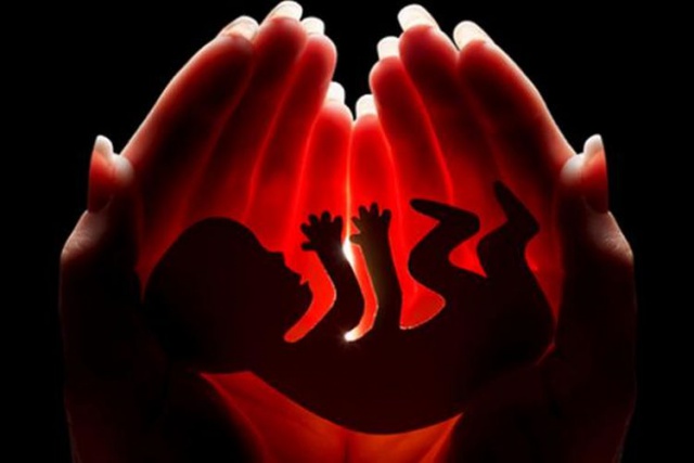 Aborsi Menurut Hukum Positif Indonesia